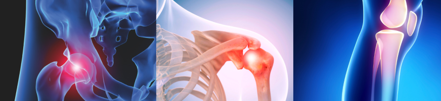 hanche, épaule, genou - douleurs